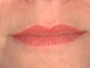 Lips