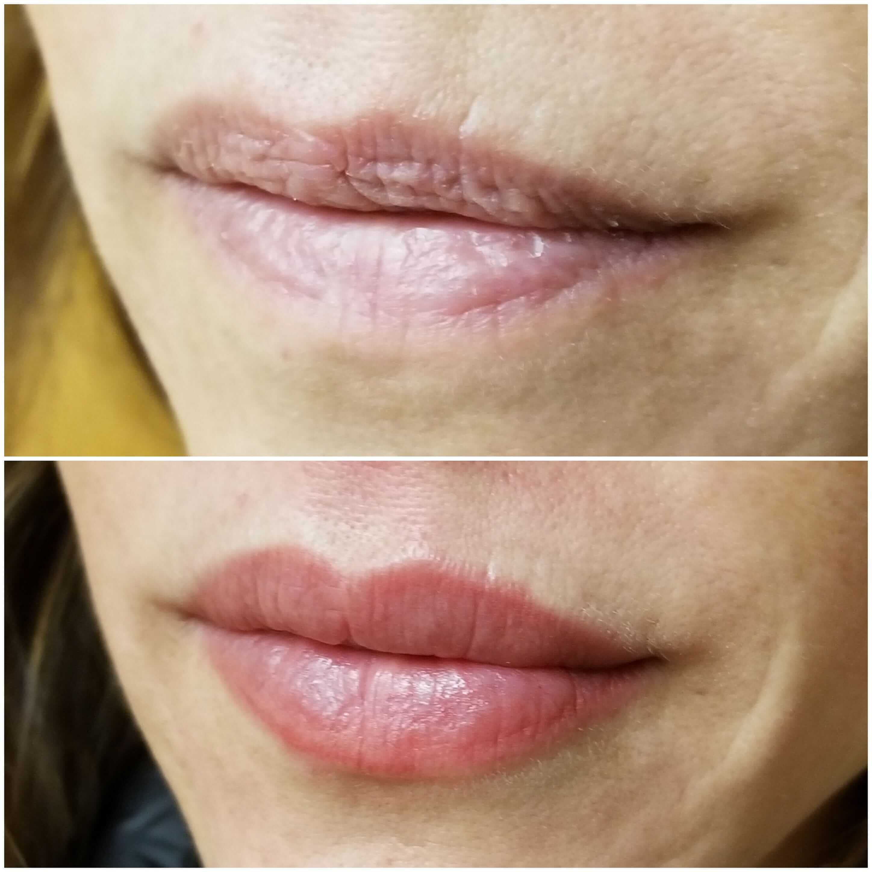 IMG_20201003_063104_889