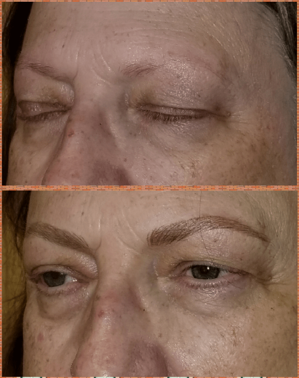 DEXATI20191201224918